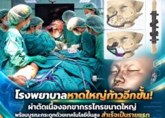 สงขลา-โรงพยาบาลหาดใหญ่ก้าวอีกขั้น ผ่าตัดเนื้องอกขากรรไกรขนาดใหญ่ พร้อมบูรณะกระดูกด้วยเทคโนโลยีขั้นสูง สำเร็จเป็นรายแรกของโรงพยาบาล